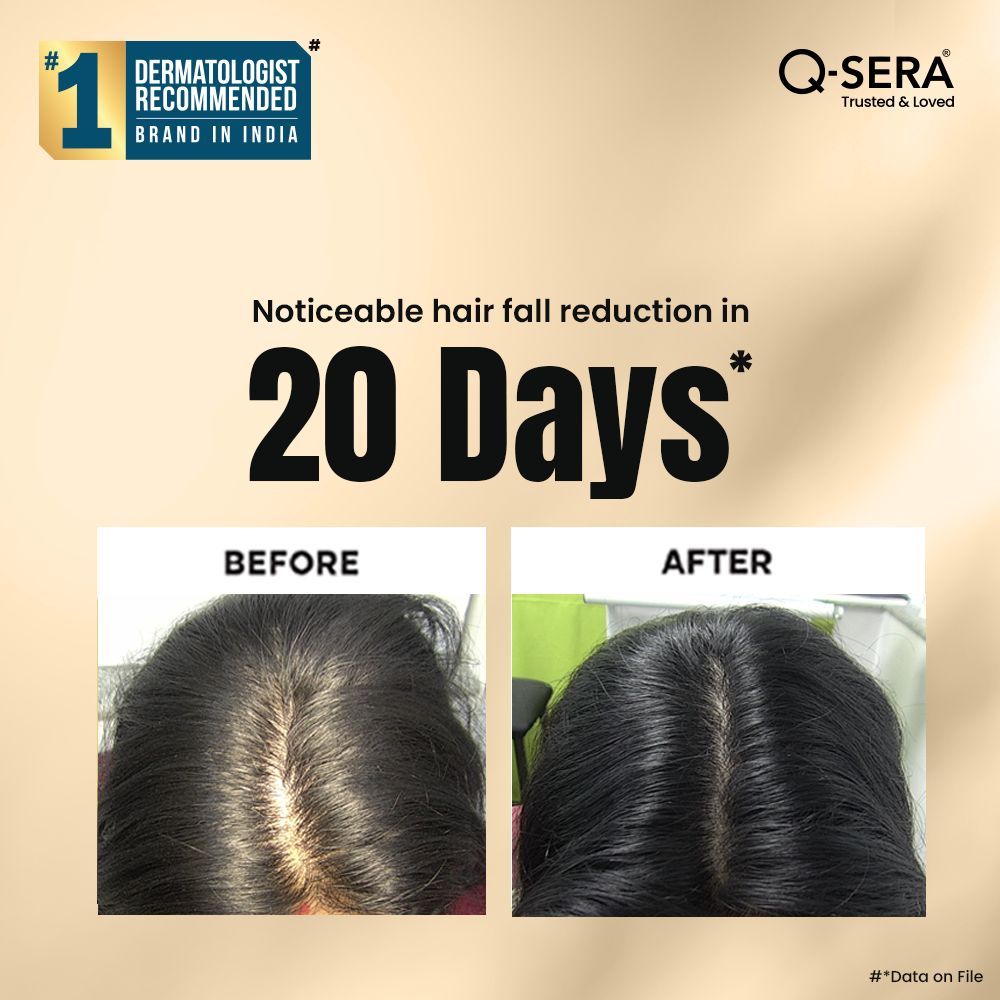 Q - Sera Hair Fall Control Serum