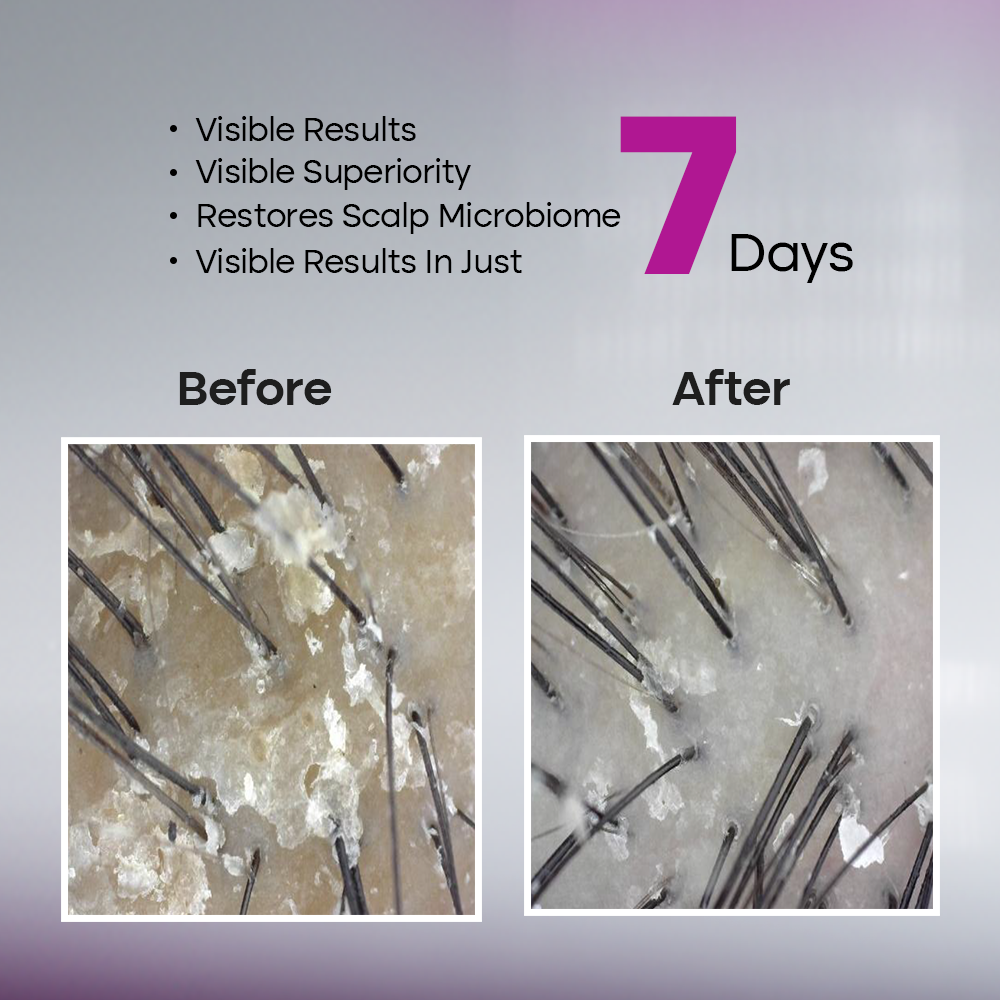 Q-SERA AD LEAVE IN HAIR SERUM
