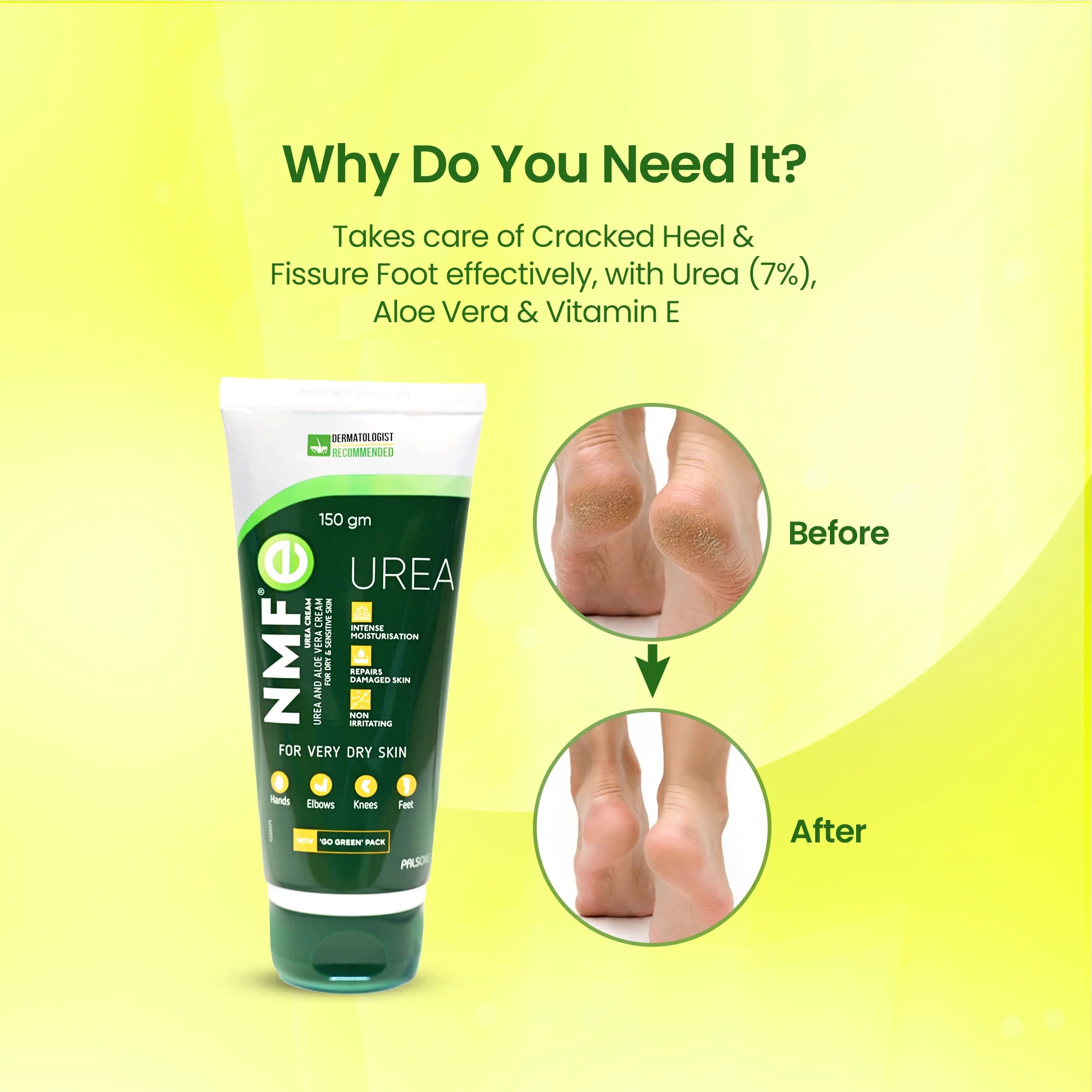 NMF-E Urea Cream 150gm