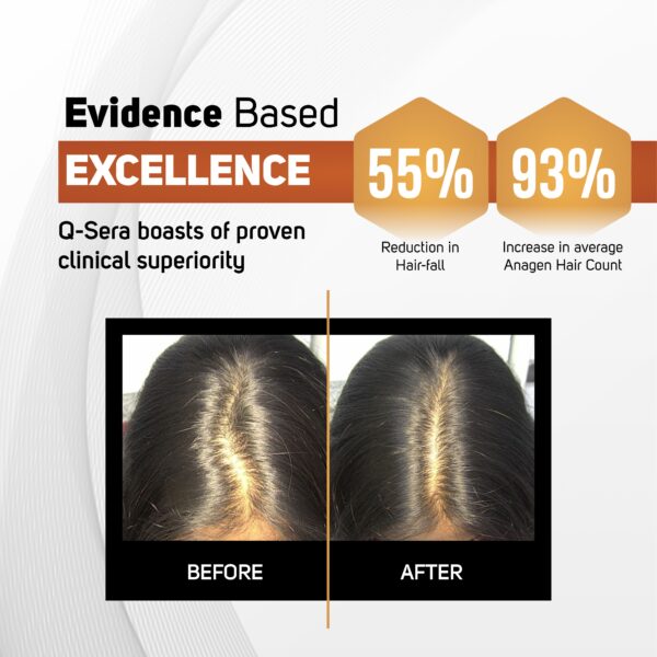 Qsera-hair-serum-2