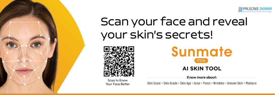 Sunmate Max